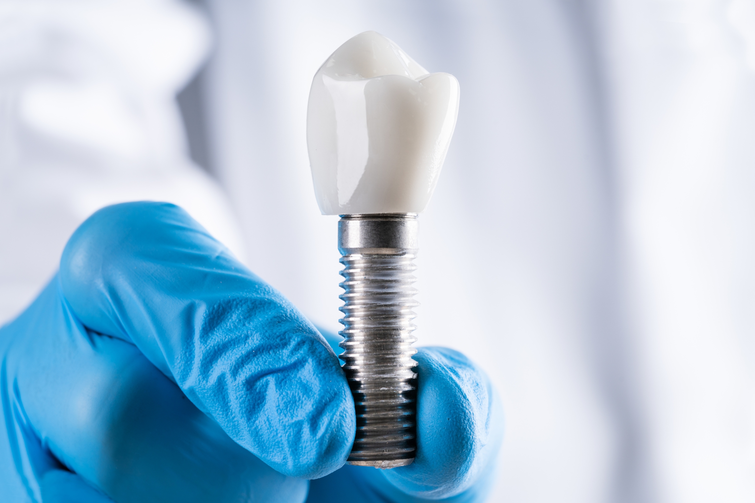 Oral Implants Abroad - What You Have To Know