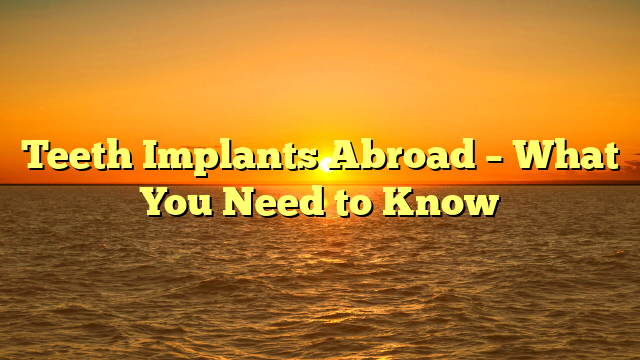 Teeth Implants Abroad – What You Need to Know